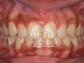 After - Ali Orthodontics Dental