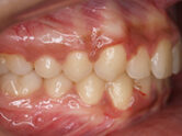 After - Ali Orthodontics Dental