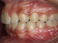 After - Ali Orthodontics Dental