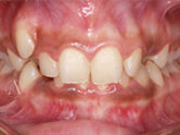Before - Ali Orthodontics Dental