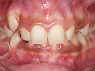 Before - Ali Orthodontics Dental