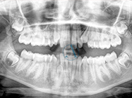 Before - Ali Orthodontics Dental