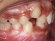 Before - Ali Orthodontics Dental