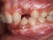 Before - Ali Orthodontics Dental