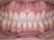 Progressive - Ali Orthodontics Dental