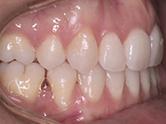 Progressive - Ali Orthodontics Dental