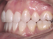 Progressive - Ali Orthodontics Dental