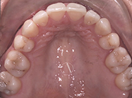 Progressive - Ali Orthodontics Dental