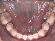 Progressive - Ali Orthodontics Dental