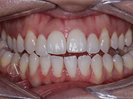 Progressive - Ali Orthodontics Dental