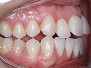 Progressive - Ali Orthodontics Dental