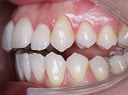 Progressive - Ali Orthodontics Dental