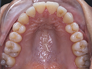 Progressive - Ali Orthodontics Dental