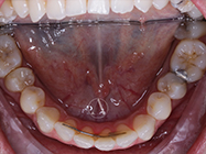 Progressive - Ali Orthodontics Dental