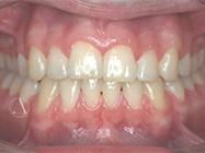 Progressive - Ali Orthodontics Dental