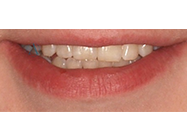 Progressive - Ali Orthodontics Dental