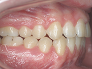 Progressive - Ali Orthodontics Dental