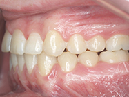 Progressive - Ali Orthodontics Dental