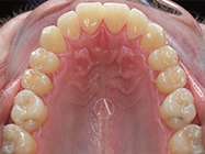 Progressive - Ali Orthodontics Dental