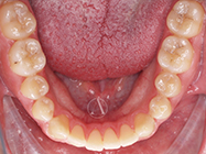 Progressive - Ali Orthodontics Dental