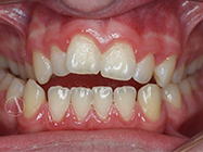 Progressive - Ali Orthodontics Dental