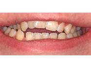 Progressive - Ali Orthodontics Dental