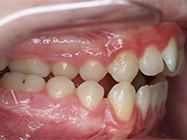 Progressive - Ali Orthodontics Dental