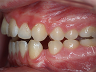 Progressive - Ali Orthodontics Dental