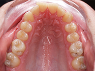 Progressive - Ali Orthodontics Dental