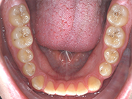 Progressive - Ali Orthodontics Dental