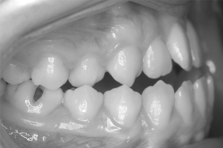 Before - Ali Orthodontics Dental