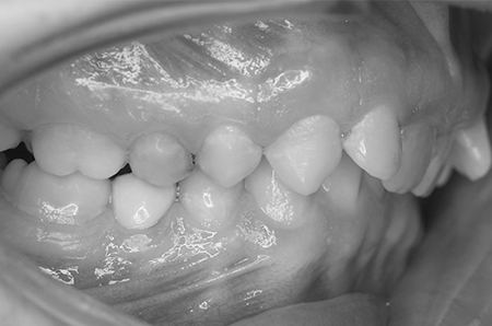 Before - Ali Orthodontics Dental