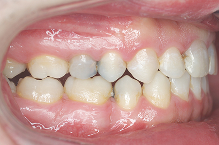 After - Ali Orthodontics Dental
