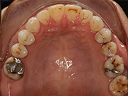 After - Ali Orthodontics Dental
