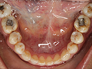 After - Ali Orthodontics Dental