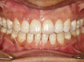 After - Ali Orthodontics Dental