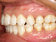 After - Ali Orthodontics Dental