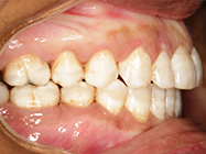 After - Ali Orthodontics Dental