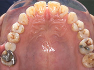 Before - Ali Orthodontics Dental