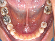 Before - Ali Orthodontics Dental