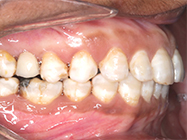 Before - Ali Orthodontics Dental