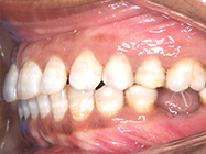 Before - Ali Orthodontics Dental